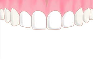 治療後イメージ