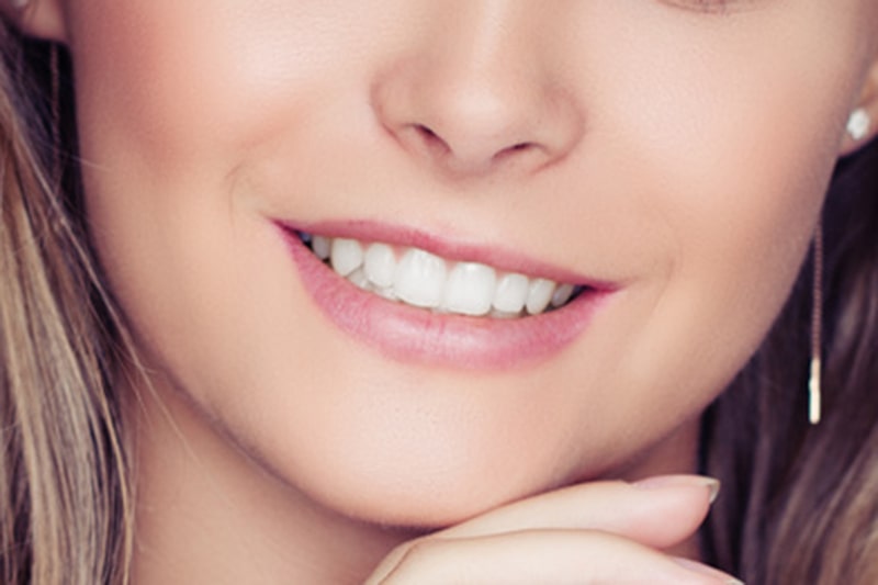 国内制作の高精度なセラミック歯を使用