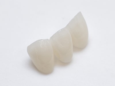 エステティックデザインオールセラミック歯