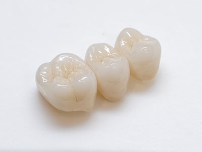 エステティックデザインダイヤモンドジルコニアセラミック歯