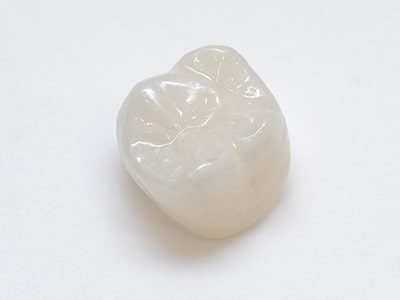 奥歯ホワイトジルコニアクラウン