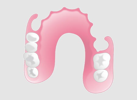 ノンクラスプデンチャーイメージ